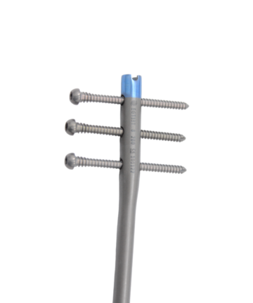 Humerus Interlocking Nail