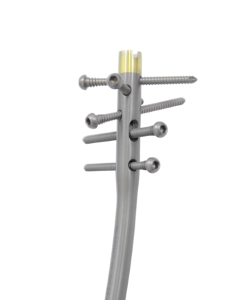 Multihole Tibia Interlocking Nail