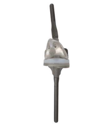 Hinged Knee Replacement